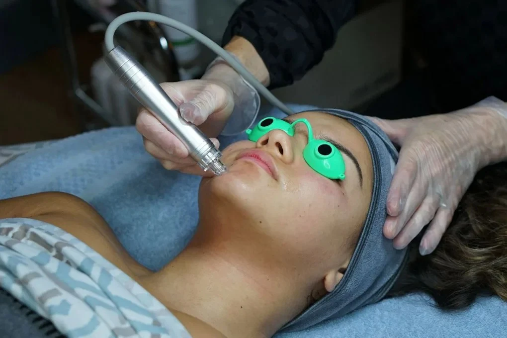 Hydrofacial Fort Myers